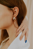 Jaw is popping featuring close up of woman jaw.